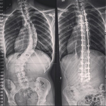 Xrays_369x532-
